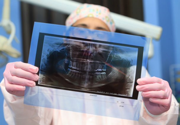 X-rays